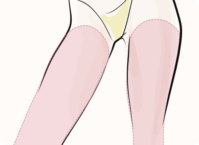 脂肪吸引（足）（スタンダード）